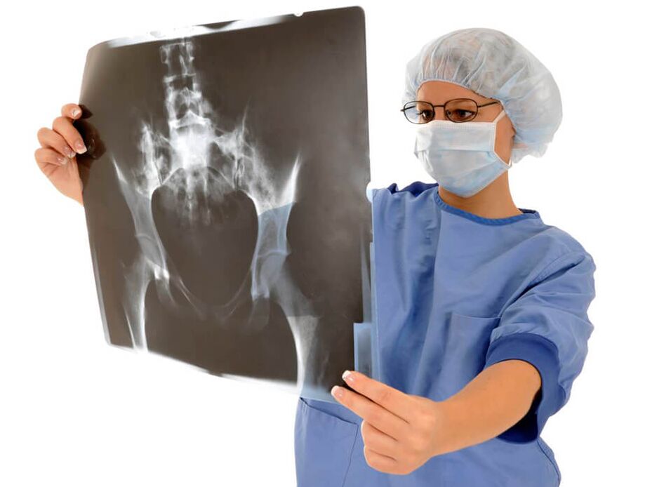 La radiografía de la articulación de la cadera ayudará al médico a determinar la causa del dolor. 