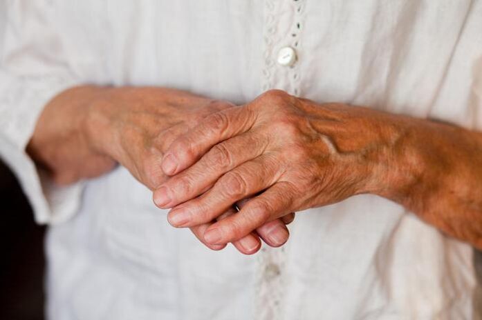 El dolor en las articulaciones de las manos suele molestar a las personas mayores. 
