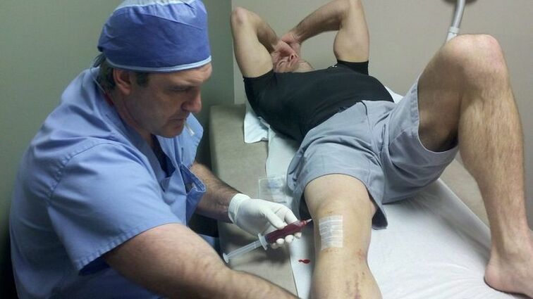 Tratamiento de la artrosis de la articulación de la rodilla